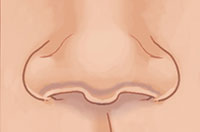 Nn nose