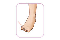 toe