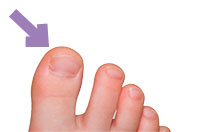 toe