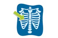 rib