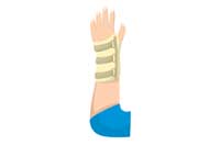 splint